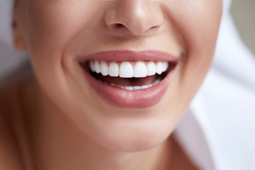 Young woman smiling with beautiful white teeth with all on 4 implants from Mountain State Oral and Facial Surgery in Charleston, WV