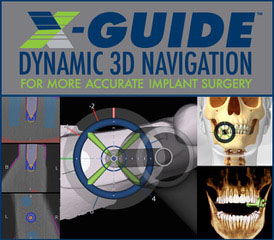 X-Guide logo and collage of X-guide diagrams