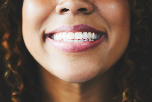 Close up of a beautiful woman smiling after oral surgery at Mountain State Oral and Facial Surgery in Vinton, VA