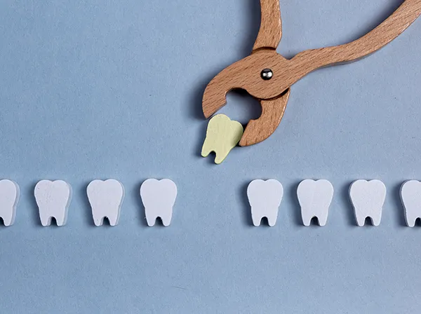 Row of wooden tooth shapes, one of which is being pulled out of the row by dental pliers, illustrating wisdom tooth removal from Mountain State Oral and Facial Surgery in Huntington, WV